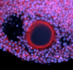 The oocyte and surrounding somatic cells