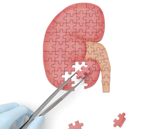 Kidney puzzle being assembled with tweezers