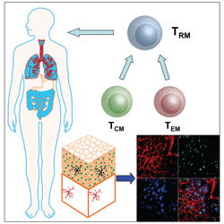 Tissue Resident Memory T Cells (TRM) generated by skin vaccination Tissue Resident Memory T Cells (TRM) generated by skin vaccination