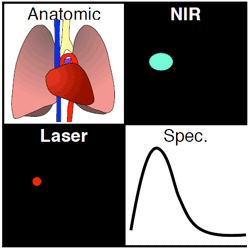 Diagram of an integrated multichannel imaging system for intraoperative cancer detection and image-guided surgery Diagram of an integrated multichannel imaging system for intraoperative cancer detection and image-guided surgery