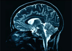 New molecules for understanding and treating diseases of the central nervous system