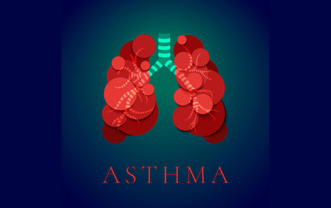 Extracellular RNA May Be Involved in Response to Asthma Attacks