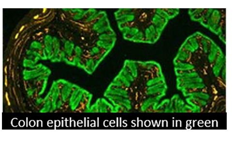 Colon Epithelial Cells.
