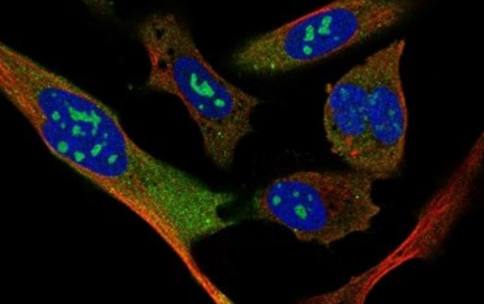 Immunofluorescence image of the target protein stained green, the nuclei are represented in blue, and the cytoskeleton are in red. The photo is credited to the Human Protein Atlas. Immunofluorescence image of the target protein stained green