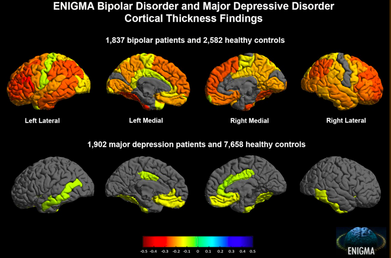 Brain aging in major depressive disorder: results from the ENIGMA