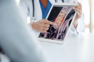 Doctor holding spine imaging results