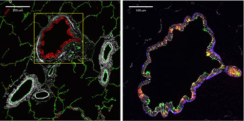 Two CODEX images of terminal bronchiole and associated vasculature