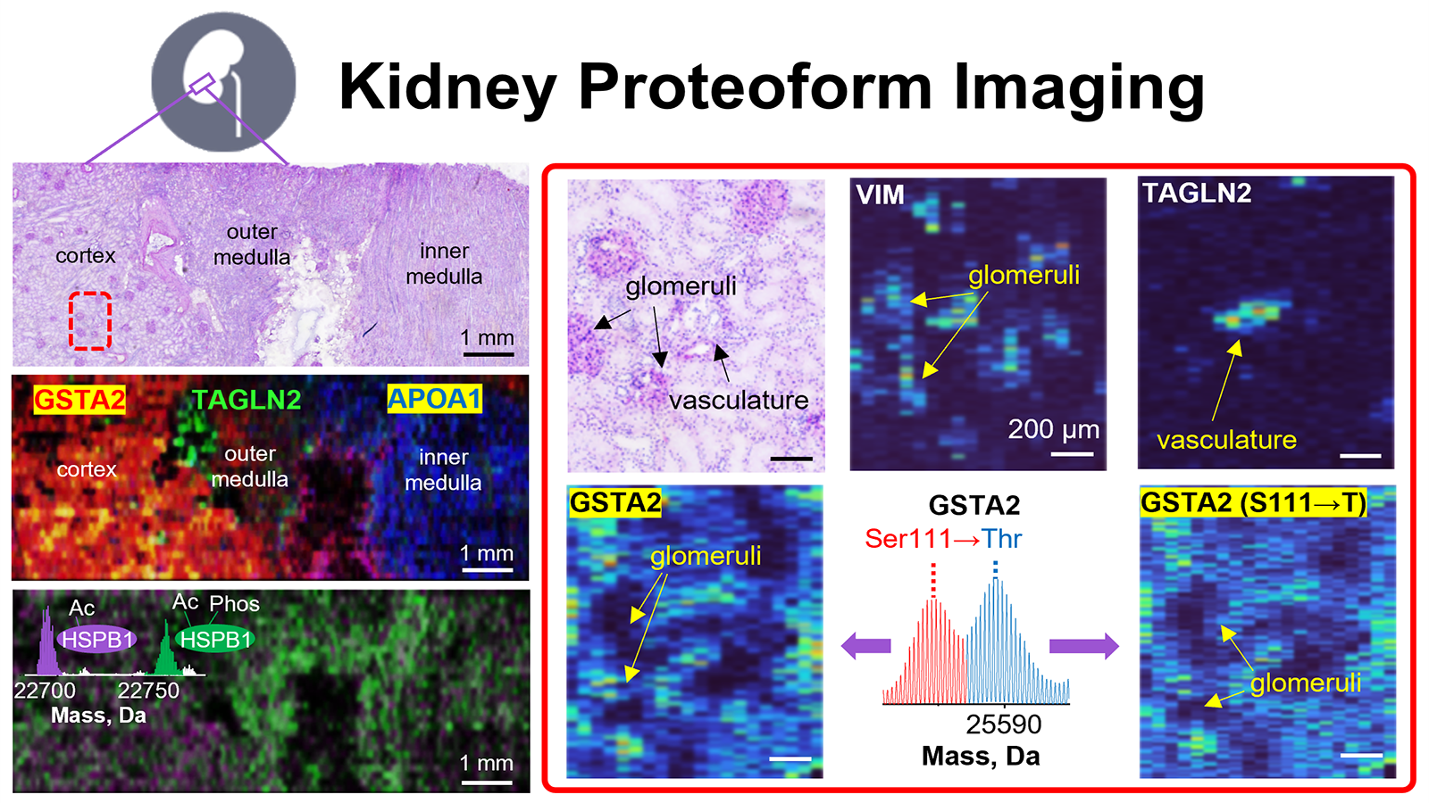 Collection of Proteoform imaging Mass Spectrometry (PiMS) images of human kidney with PAS-stained images for anatomical reference.  Glomeruli and vasculature are determined by the localization of the proteoforms.