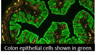 Epithelial cells of the colon