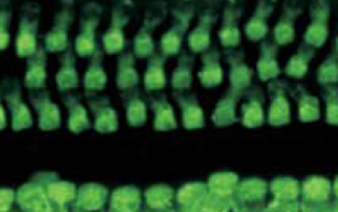 Fluorescent green image of gene edited hair cells in mice inner ear.