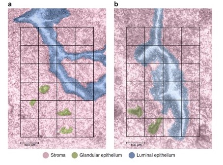 Images of mouse uterus cell types (stroma, glandular epithelium, luminal epithelium) generated by Trelliscope
