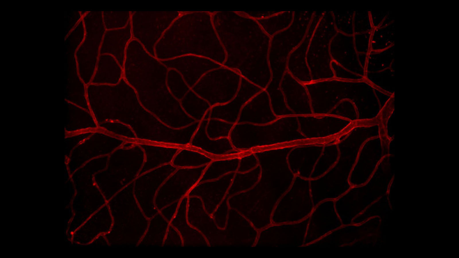 3D microscopy image of vasculature in human retina courtesy of Dr. Angela Kruse of the Spraggins Lab at Vanderbilt University