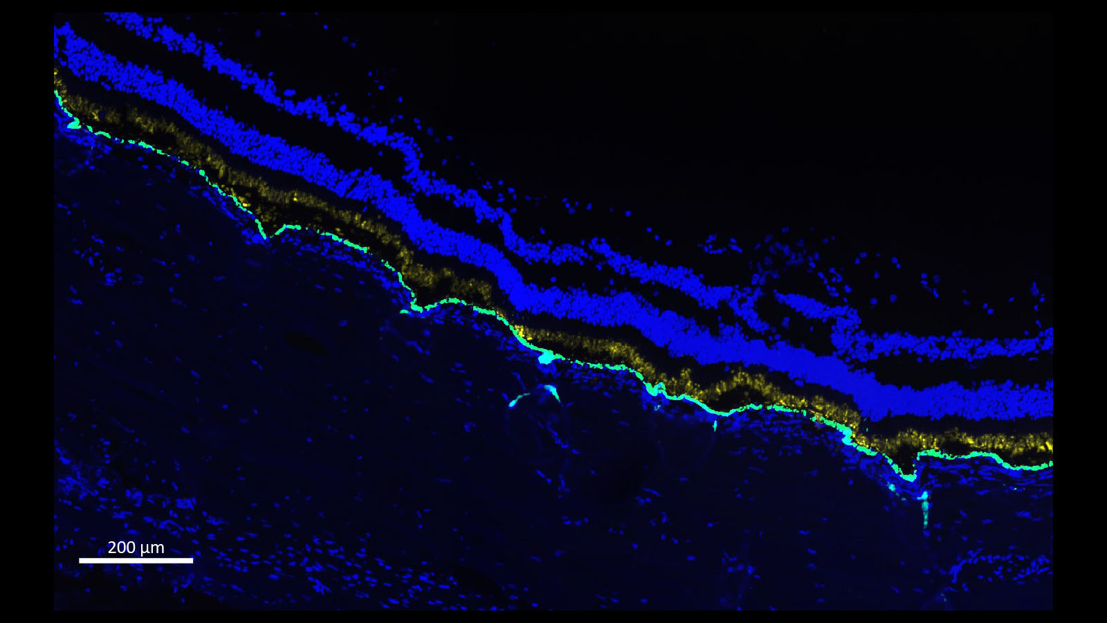 Fluorescent microscopy image of human retina, courtesy of Dr. Angela Kruse of Vanderbilt University