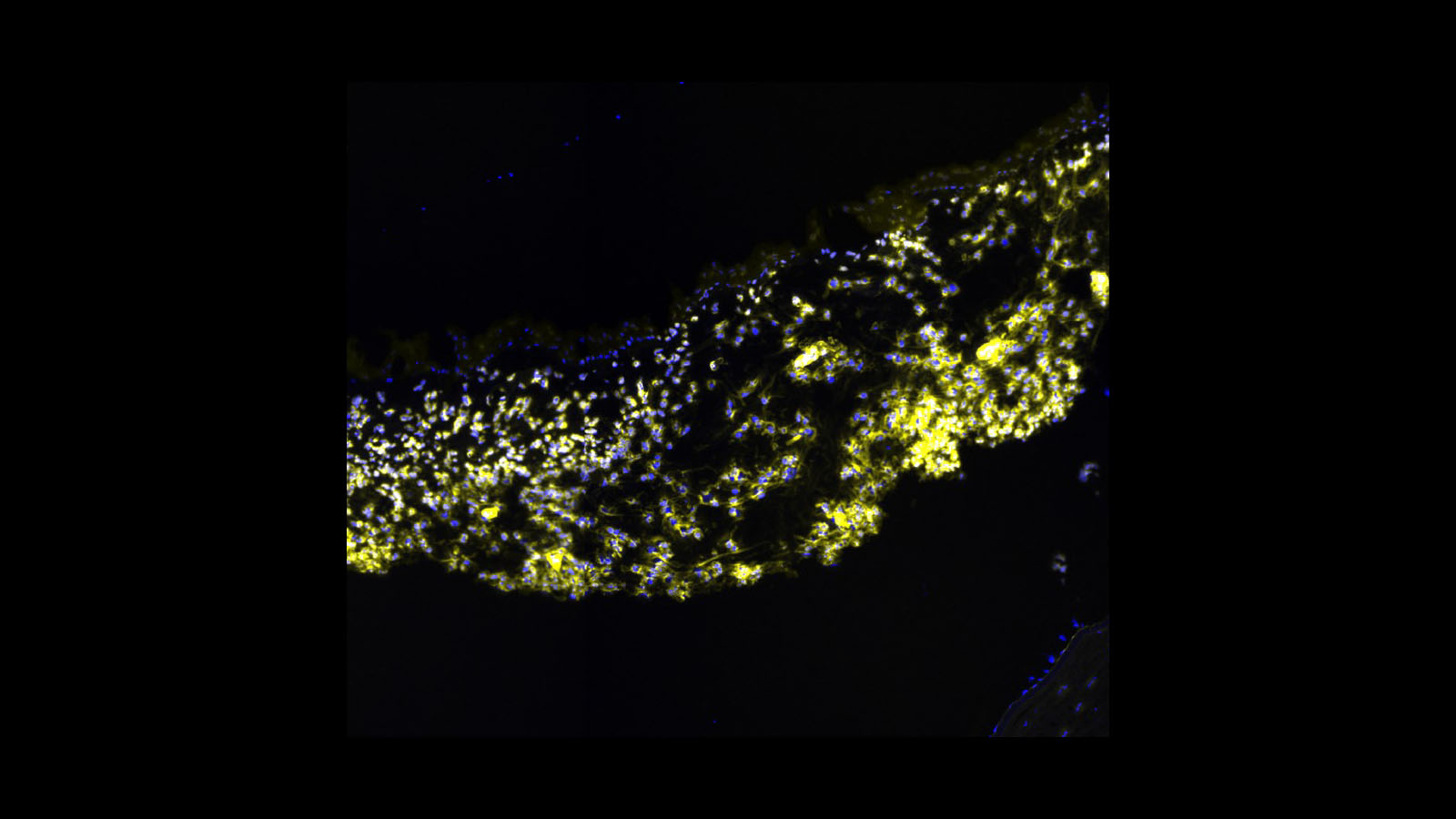 Fluorescent microscopy image of the human iris, courtesy of Dr. Angela Kruse from Vanderbilt