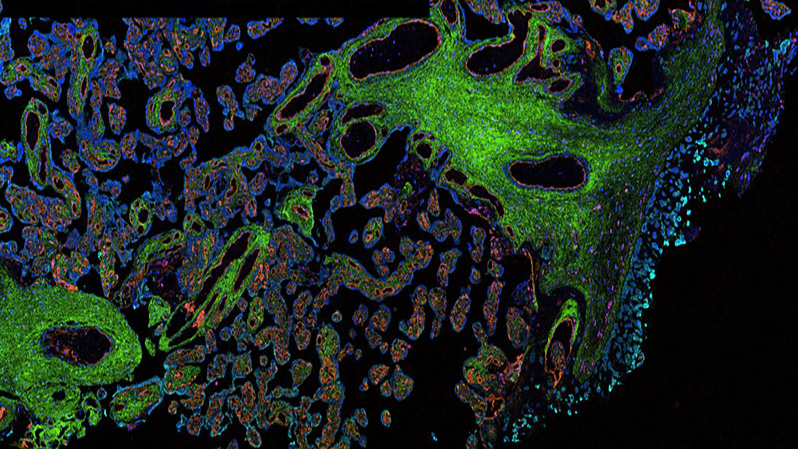 IMC image of placental trophoblasts courtesy of Dr. Santhosh Sivajothi of Jackson Labs