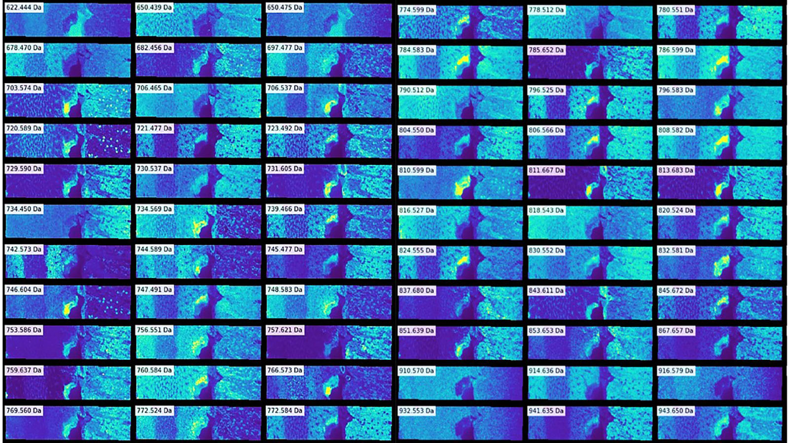 Mosaic of Imaging Mass Spec images of human kidney, courtesy of Dr. Elizabeth Neumann of Vanderbilt