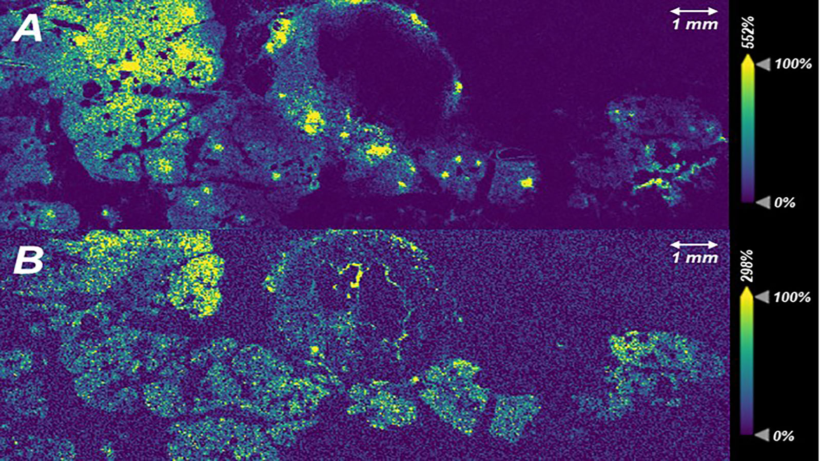 MALDI-IMS image of pancreas courtesy of Kevin Zemaitis of PNNL