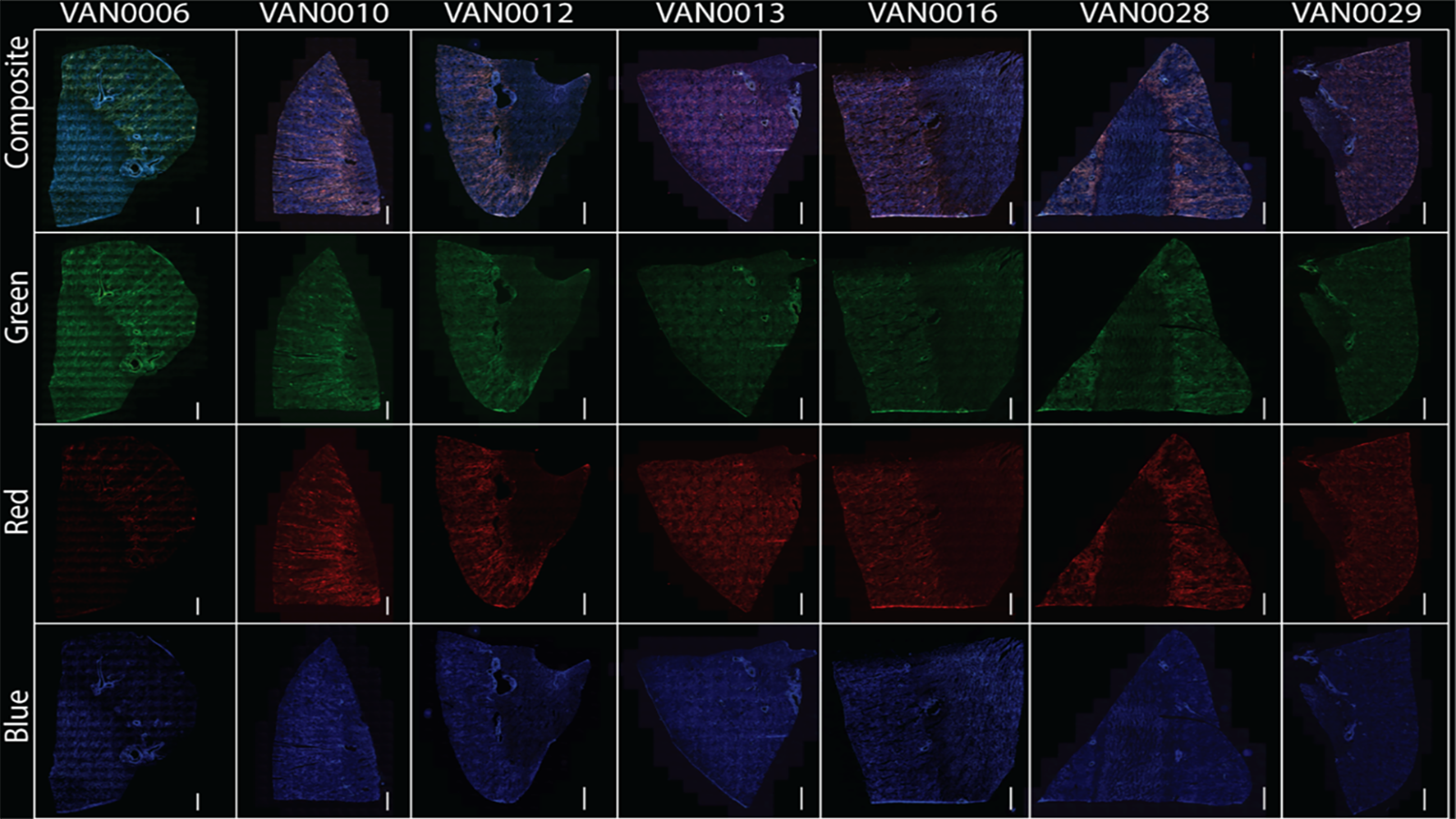 Autofluorescent images of kidneys courtesy of Dr. Elizabeth Neumann of Vanderbilt University