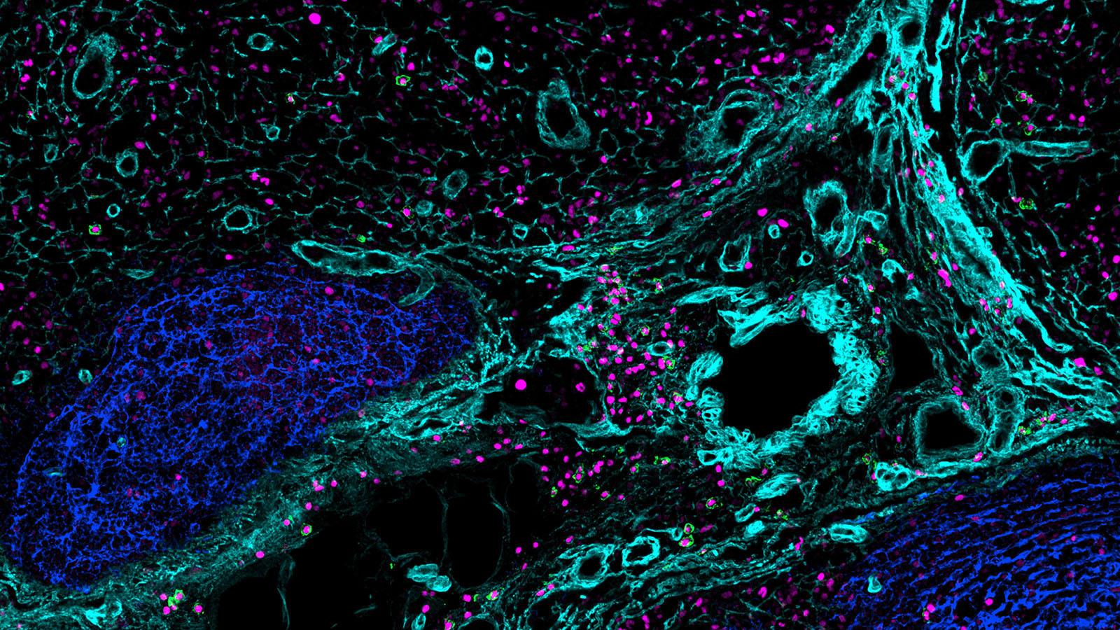 IBEX image of B cells, courtesy of Andrea Radtke at NIAID