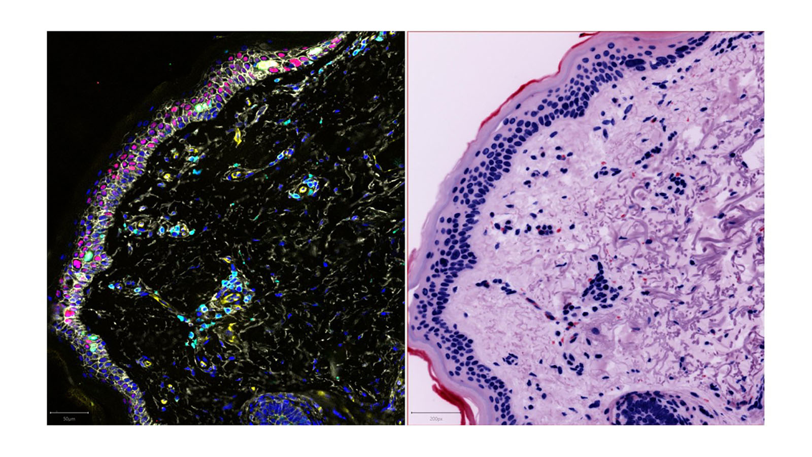 CellDIVE and H&E staining image of photoaging in response to sun exposure, courtesy of Dr. Fiona Ginty's lab at GE Research