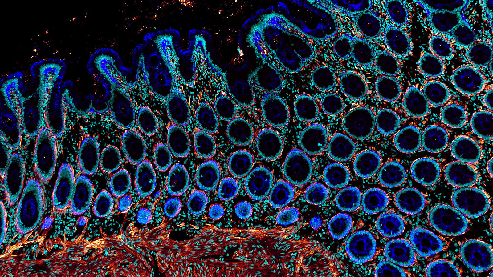 Confocal microscopy image of human colon from Dr. Andrea Radtke of the Germain lab at NIAID