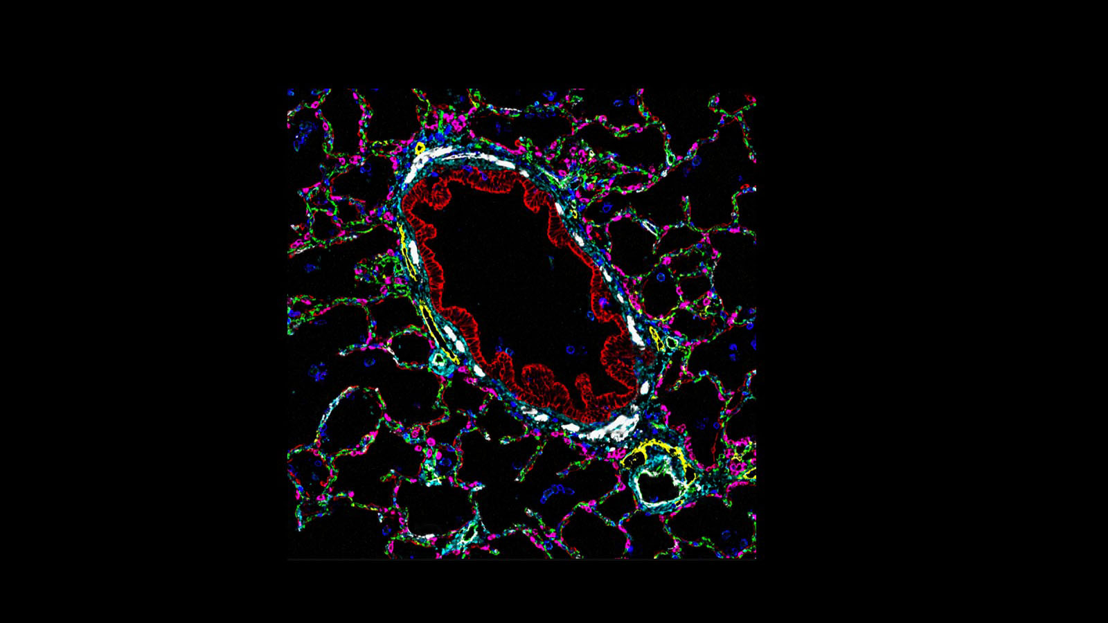 CODEX image of lung and small pulmonary arterial cells courtesy of Dr. Gloria Pryhuber