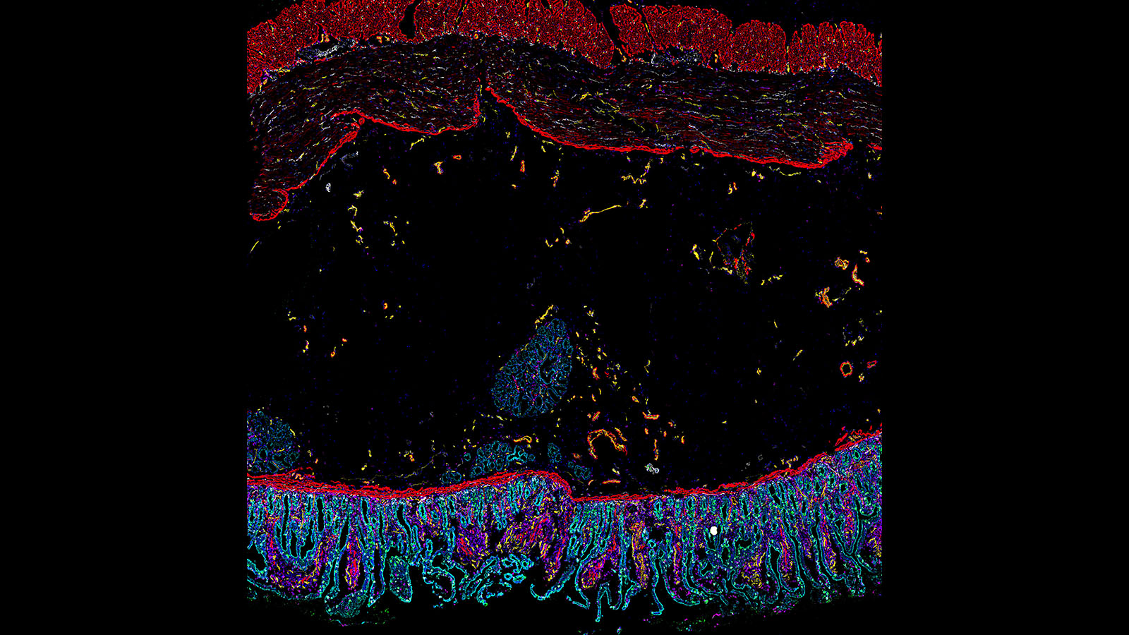 CODEX image of human intestine from Dr. John Hickey at Stanford University