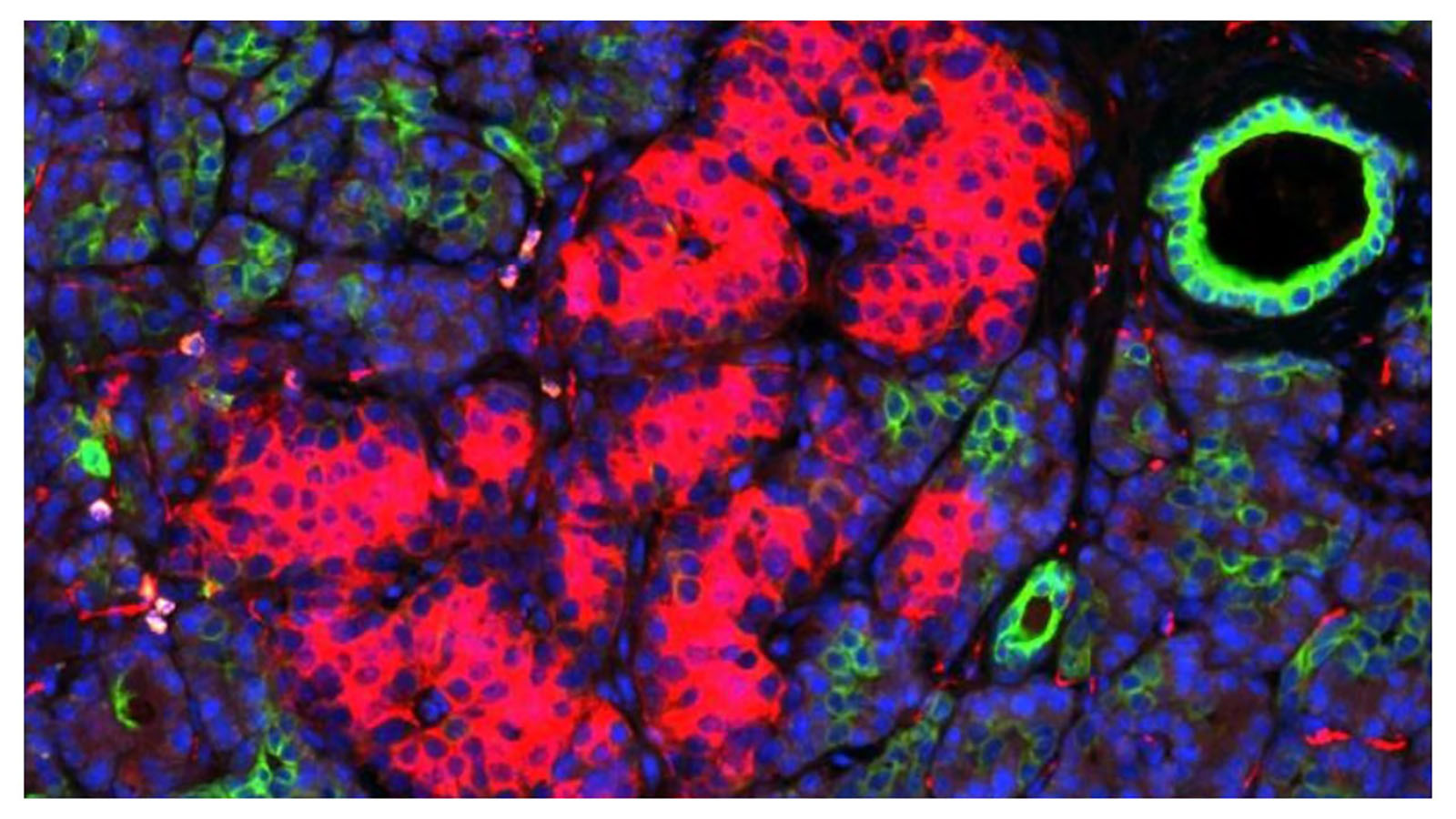 Nanostring GeoMX transcriptome image of human pancreas from Dr. Martha Campbell-Thomson at University of Florida
