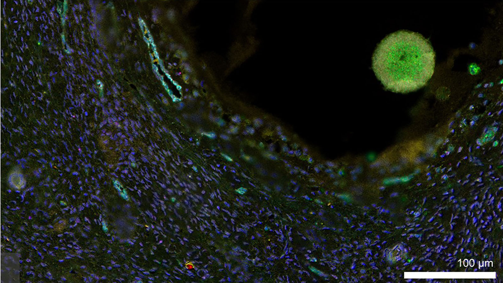 Microscopic image of an oocyte within its follicle, courtesy of Elizabeth Tsui in Dr. Monica Laronda's lab @Northwestern