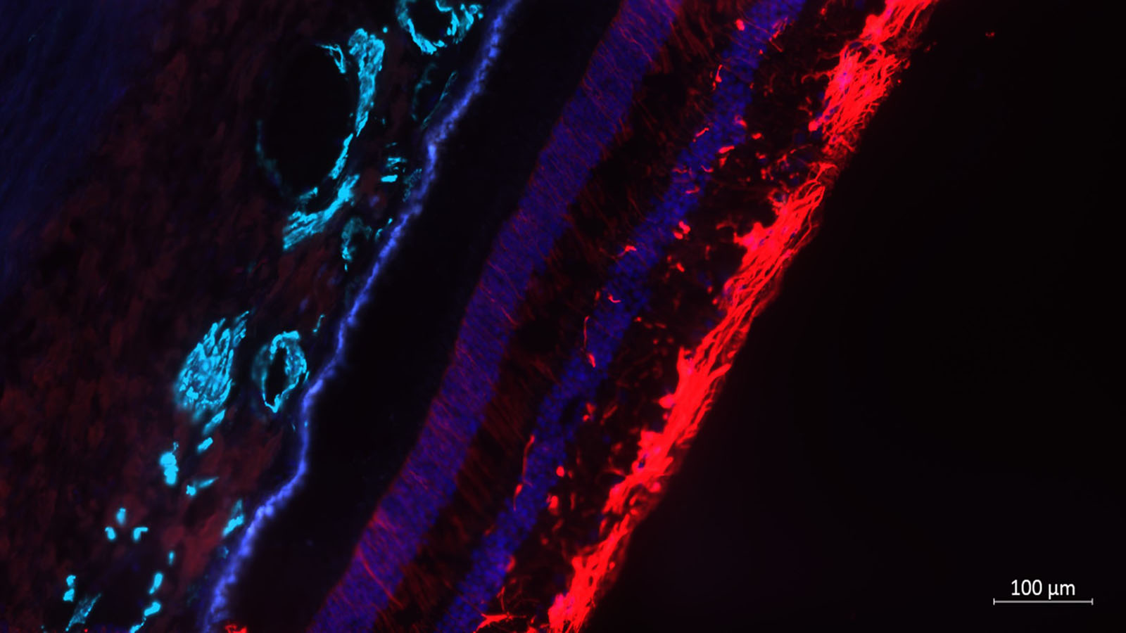 Image of a human retina from Dr. Angela Kruse at Vanderbilt