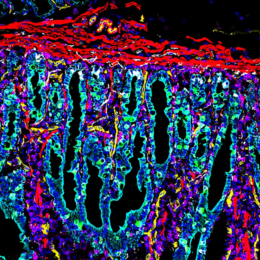 CODEX image of small intestine from Dr. John Hickey at Garry Nolan's lab at Stanford University
