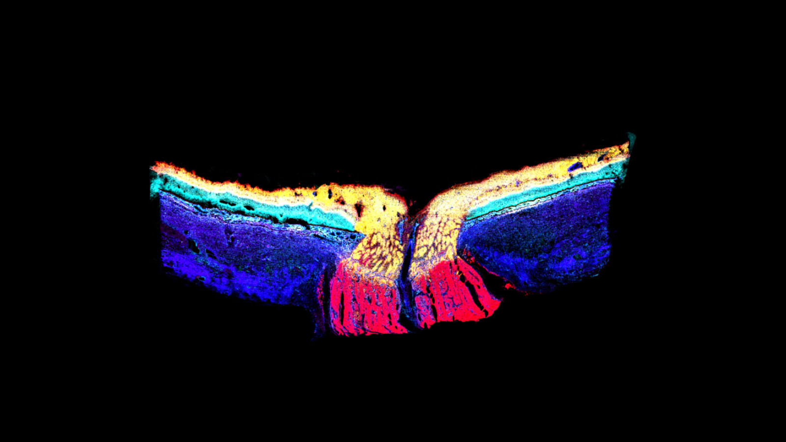 MALDI IMS image of a human optic nerve courtesy of Dr. David Anderson at Vanderbilt University