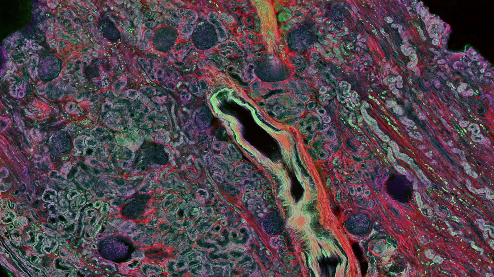 Autofluorescence image of human kidney cortex from Anthony Fung @UCSD showing the variations in cellular metabolism
