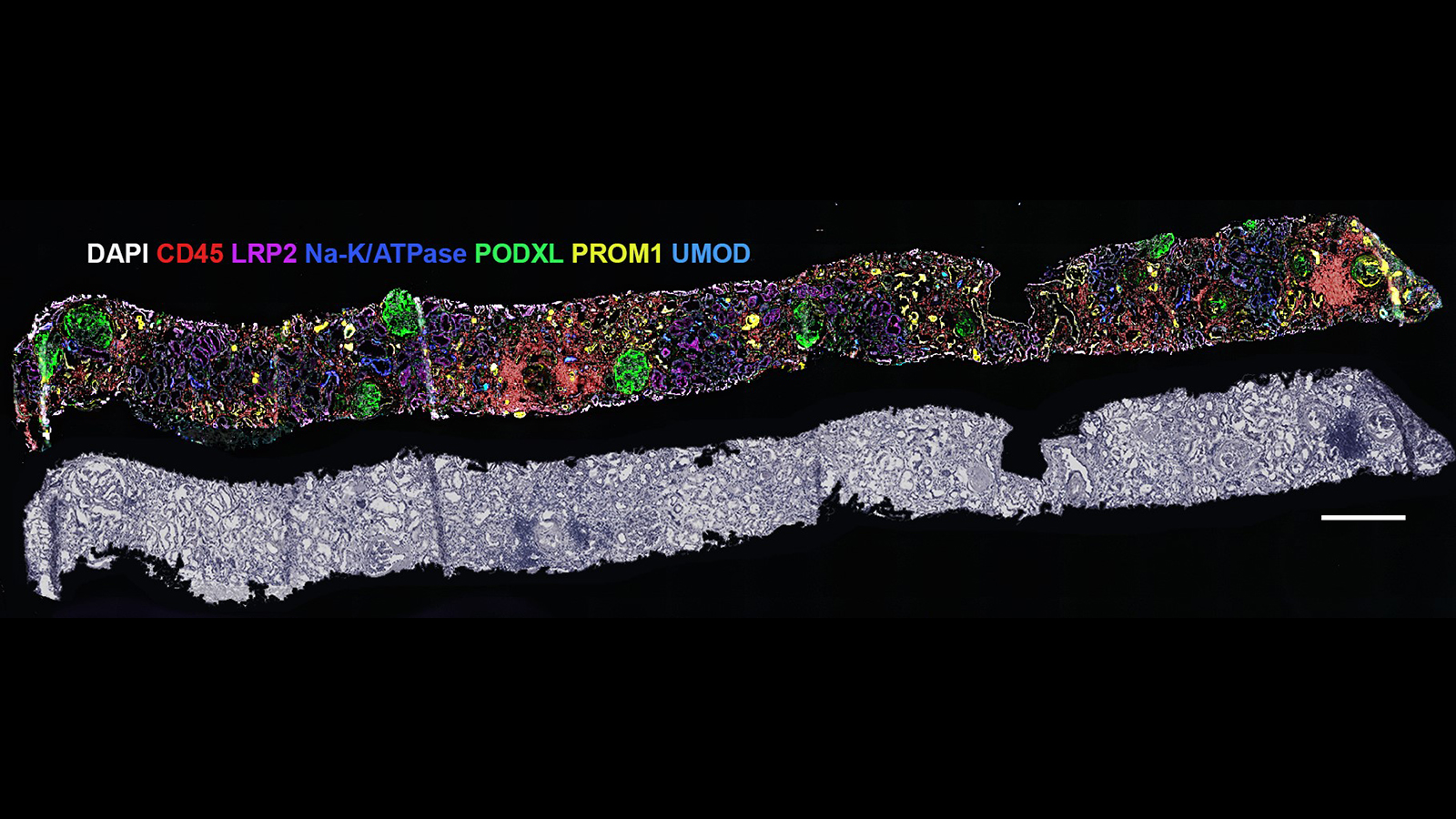 CODEX image of healthy human kidney, courtesy of Drs. Tarek Ashkar (Indiana University) and Sanjay Jain (Washington University at St. Louis)