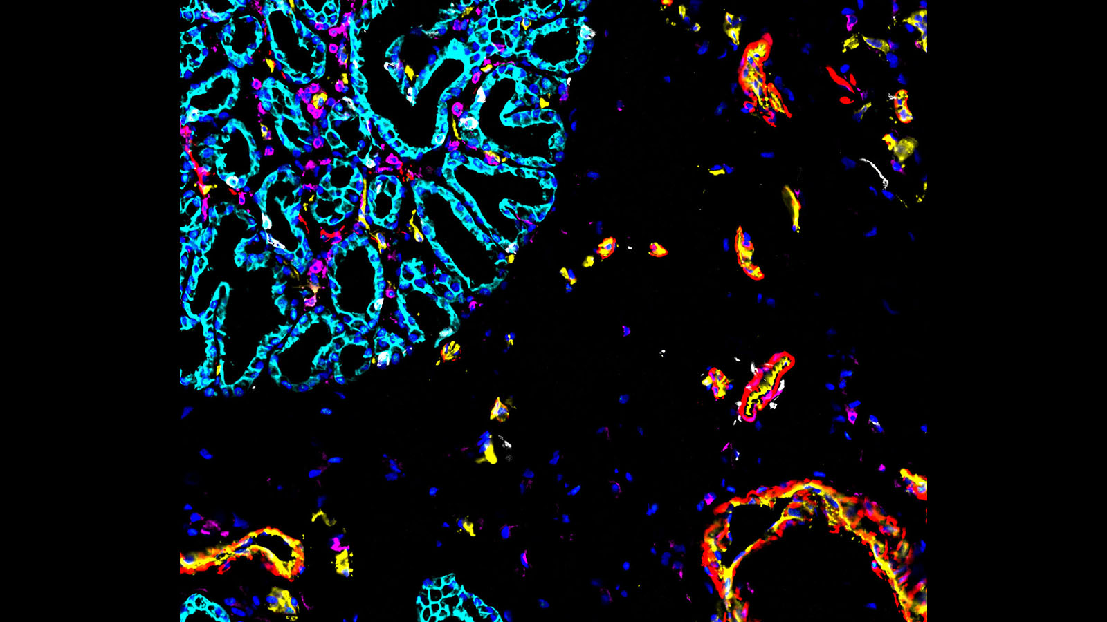 CODEX image of human intestine from Dr. John Hickey at Stanford University