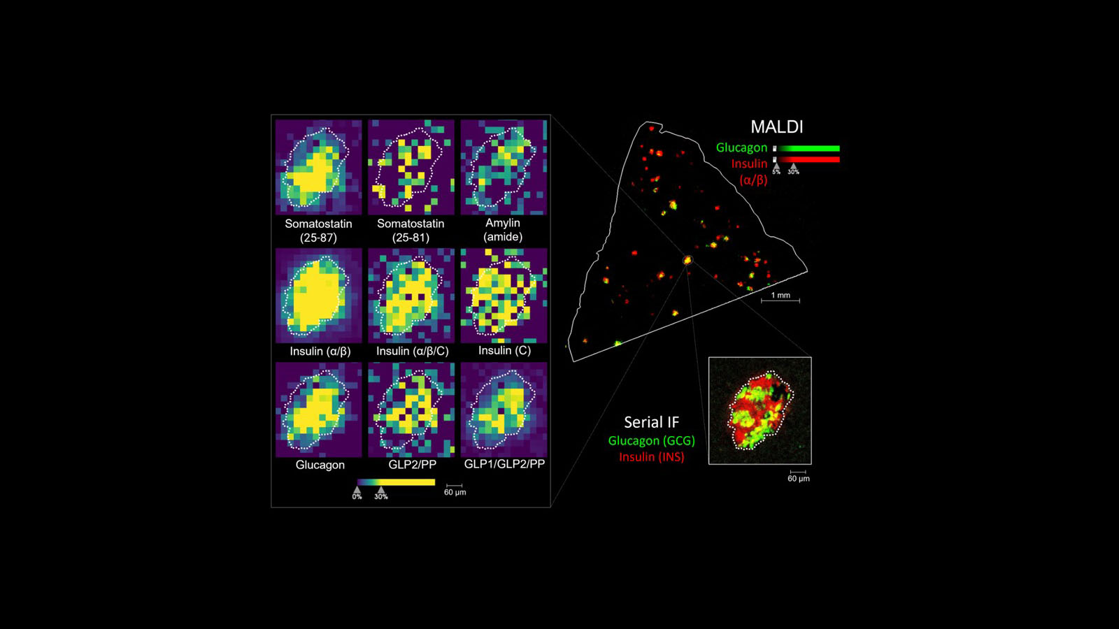 MALDI and serial immunofluorescent images of human pancreas from Dr. Kevin Zemaitis at PNNL