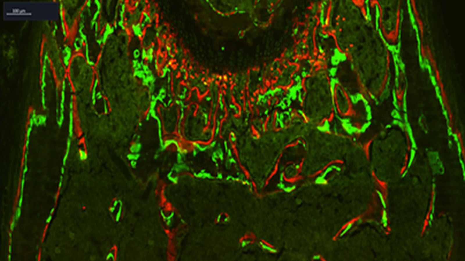 Image of a femur made with fluorescent dyes courtesy of Dr. Peter Maye at UConn.