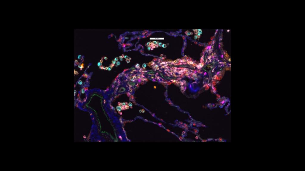 Multicolored image of fluorescent markers showing the location of different cell types throughout the lung