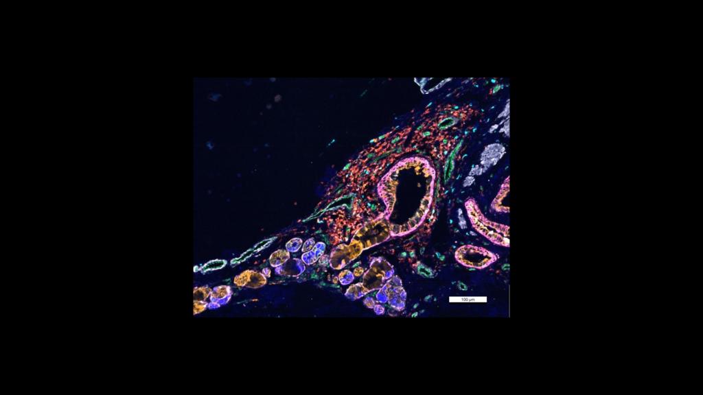 CELLDIVE image of lung cells 