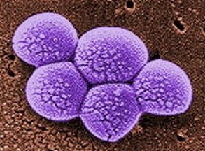 Electron microscope image of Methicillin-resistant S. aureus (MRSA) bacteria. Image courtesy of the Centers for Disease Control and Prevention (CDC).