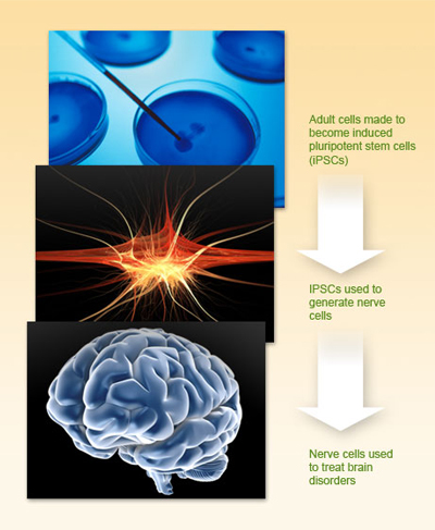 aproveitamento do potencial das células estaminais: Células adultas feitos para se tornarem células estaminais pluripotentes induzidas (iPSCs) pode ser usado para tratar distúrbios cerebrais