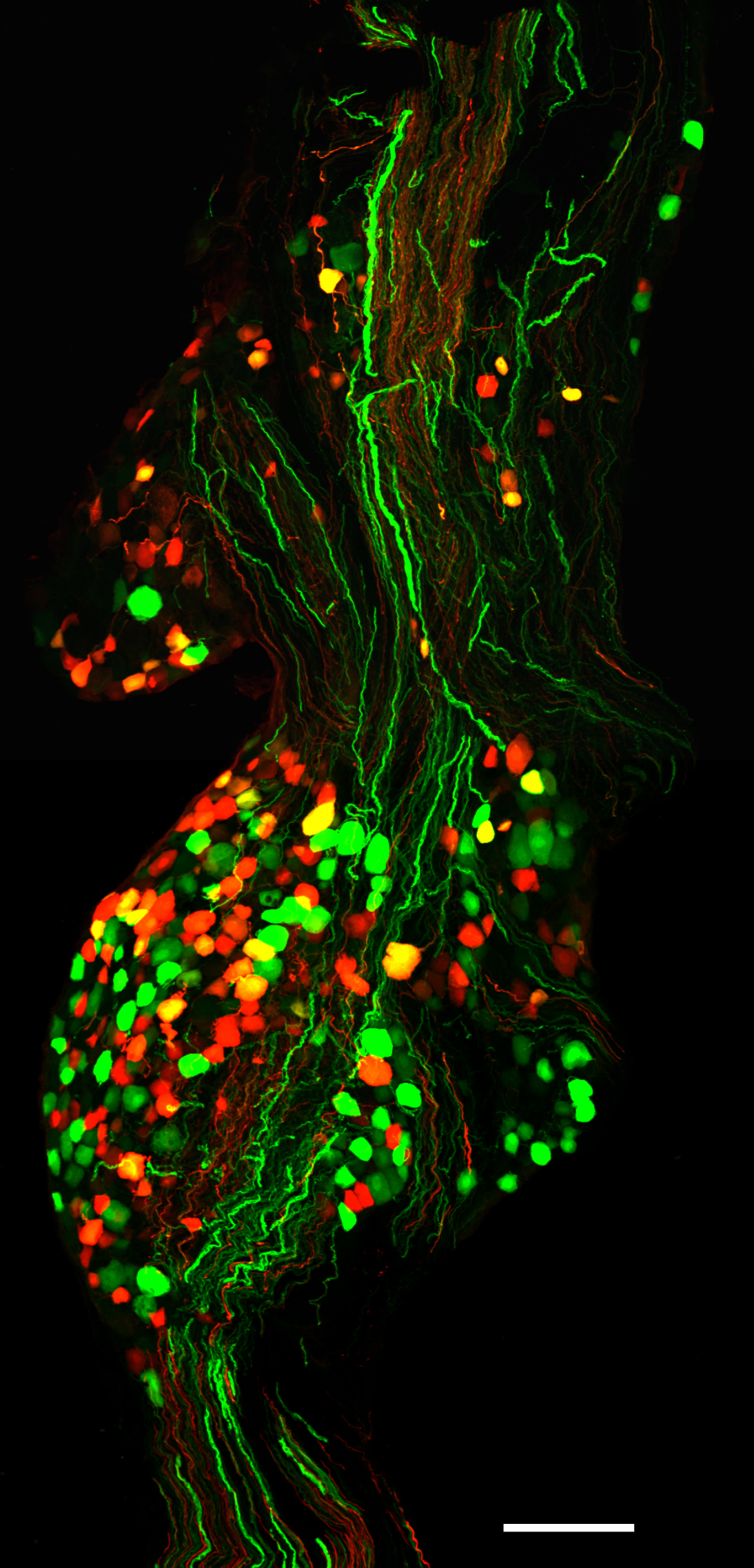 Vagal sensory neurons labeled by AAV vectors
