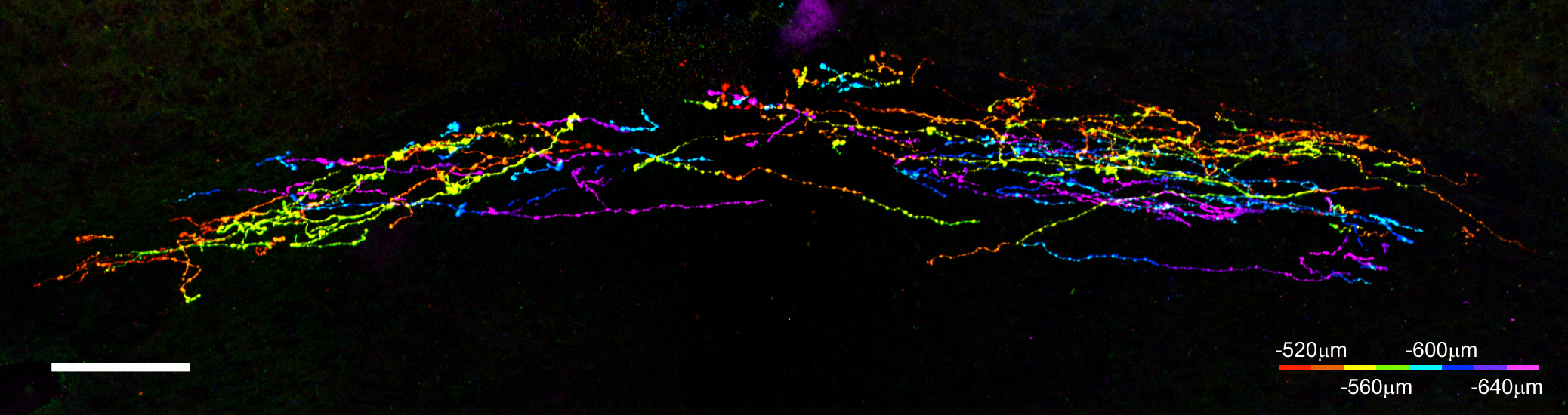 Airway Tac1+ afferents terminating in the nucleus tractus solitarius