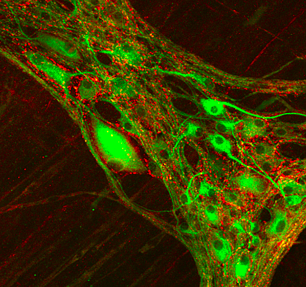 Cross talk between extrinsic (red) and intrinsic (green) cholinergic innervations in the pig colon