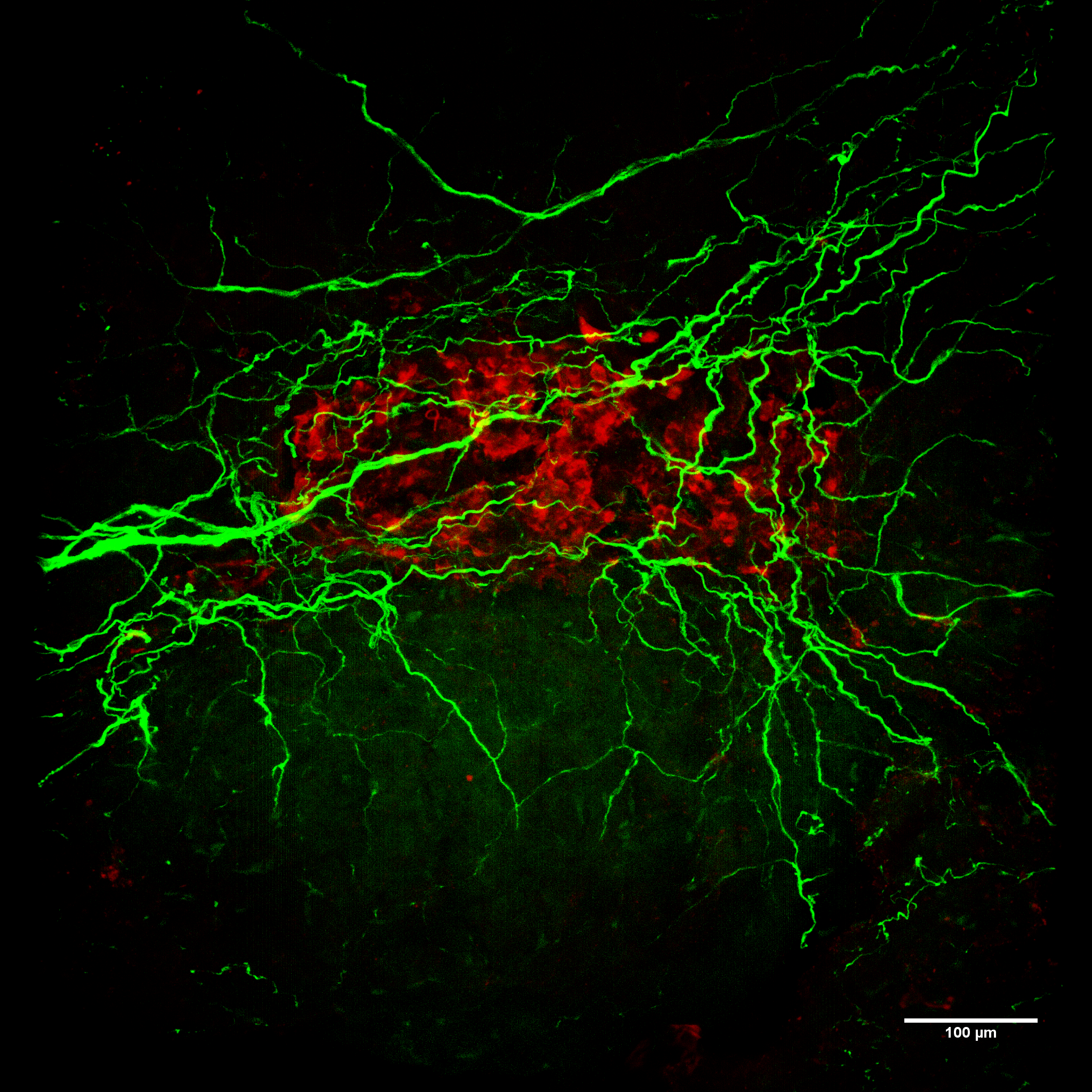 Human islet innervation