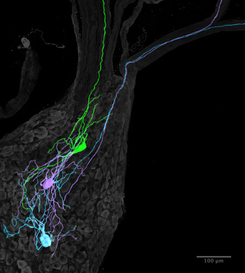 Circuitry of the Stellate Ganglion