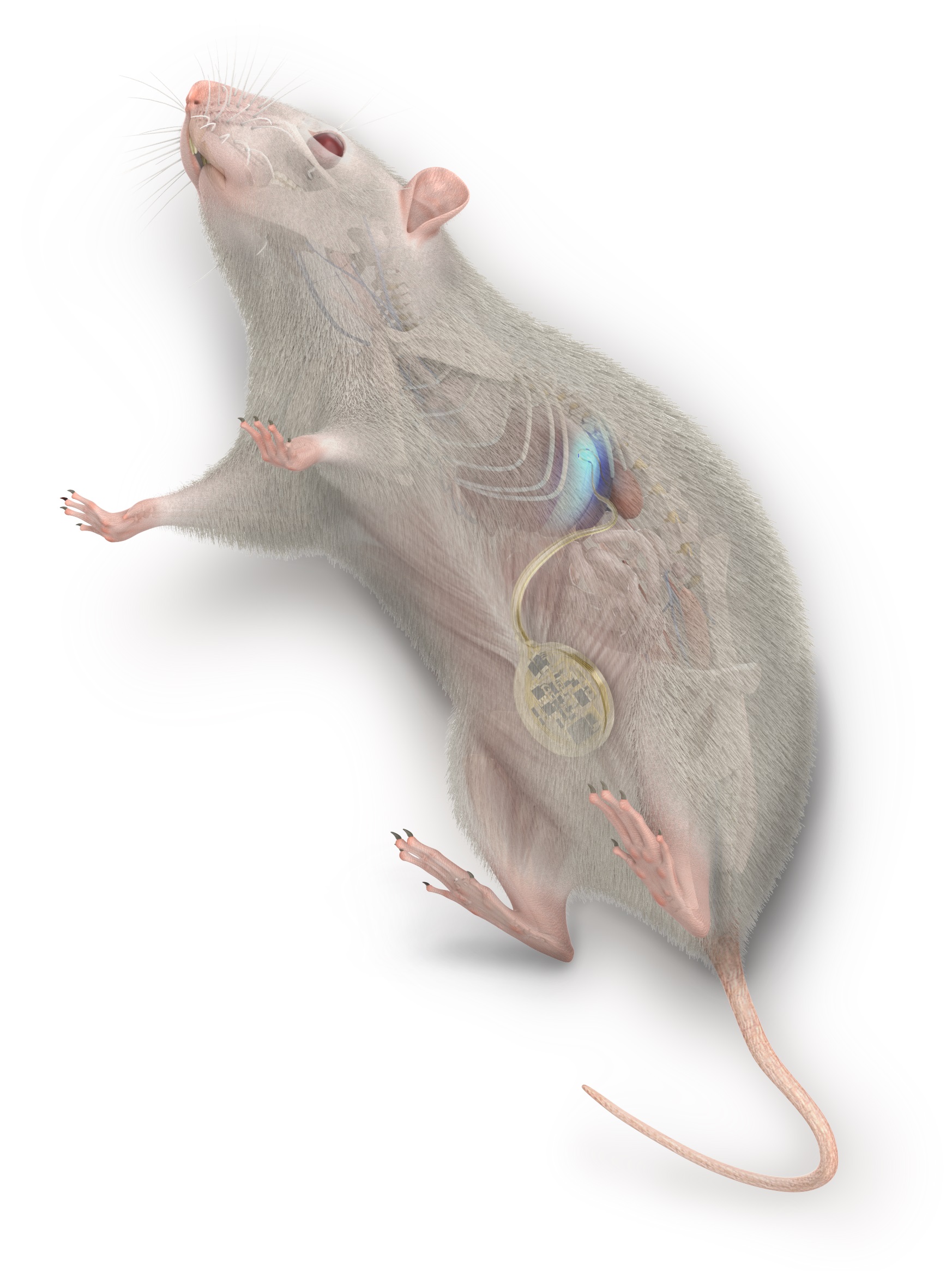 Engineering approach for the treatment of obesity