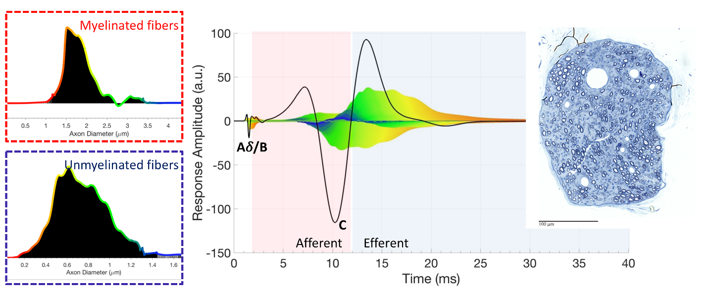 Nerve Response Decoder