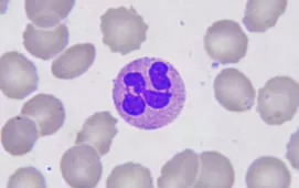 A pink, round neutrophil cell surrounded by opaque grey blood cells. The neutrophil has a dark purple, multi-lobed nucleus.