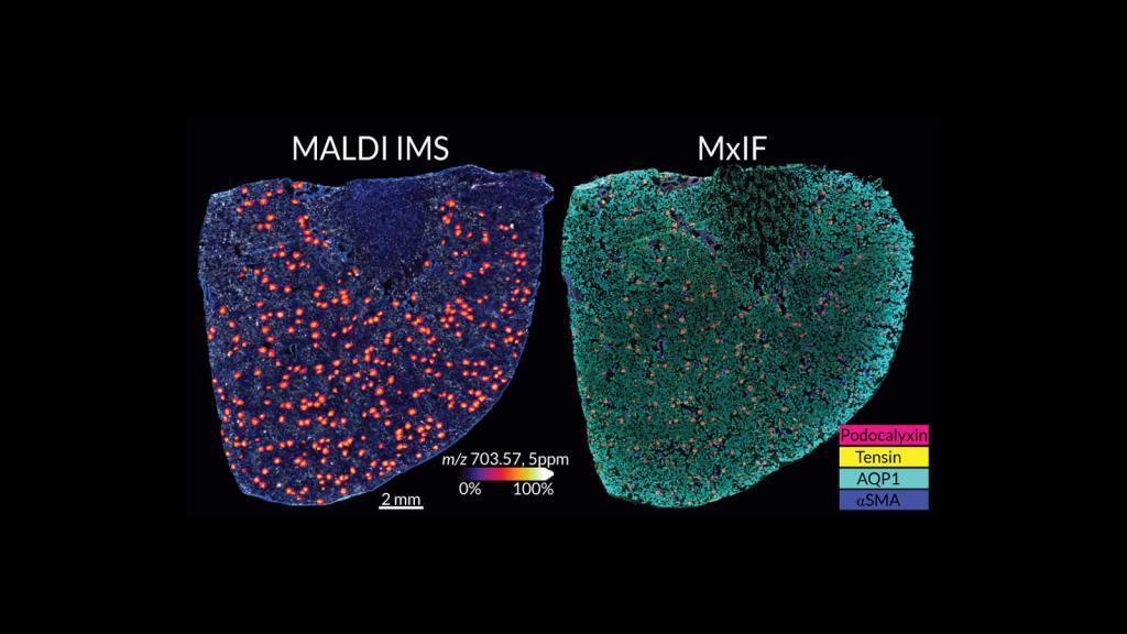 two fluorescent images of a kidney slide, one blue, and one green